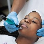 Keloids, Stretchmarks, Acne , Ozempic, Weightloss and Scars in Nairobi