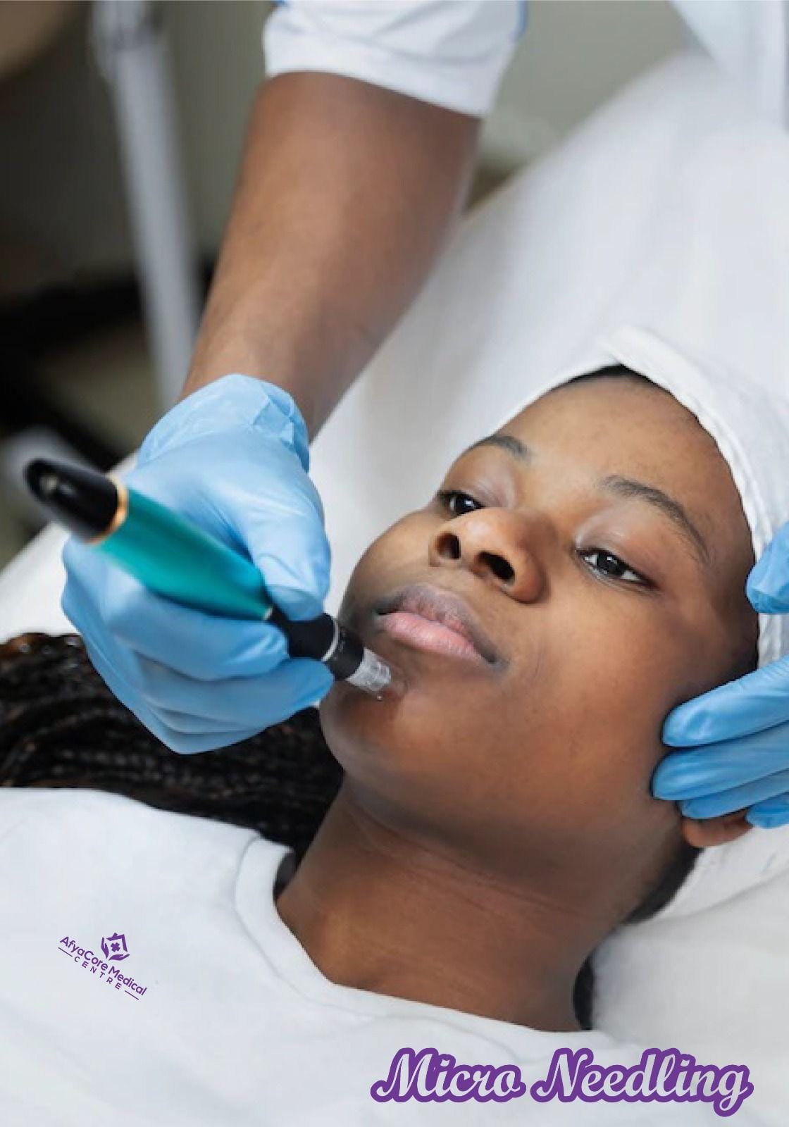 Keloids, Stretchmarks, Acne , Ozempic, Weightloss and Scars in Nairobi