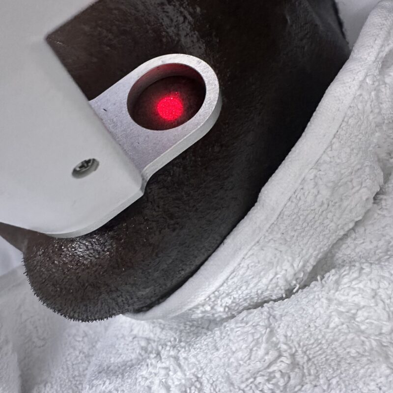 The Best Laser Hair Removal in Nairobi