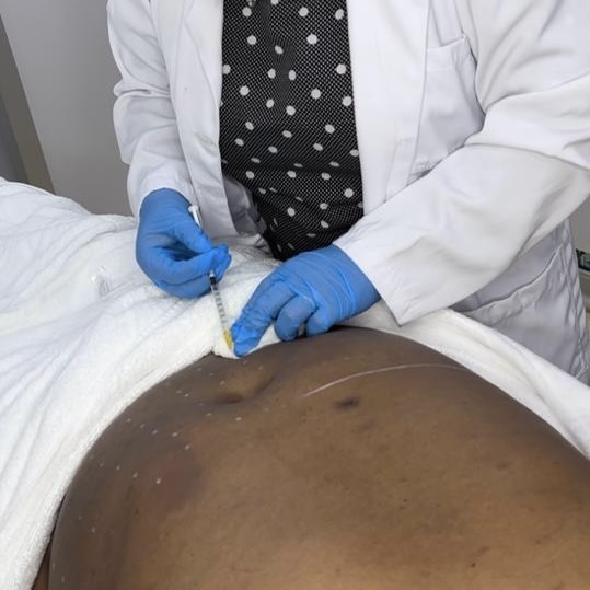 fat dissolving injections