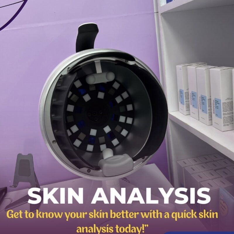 skin analysis