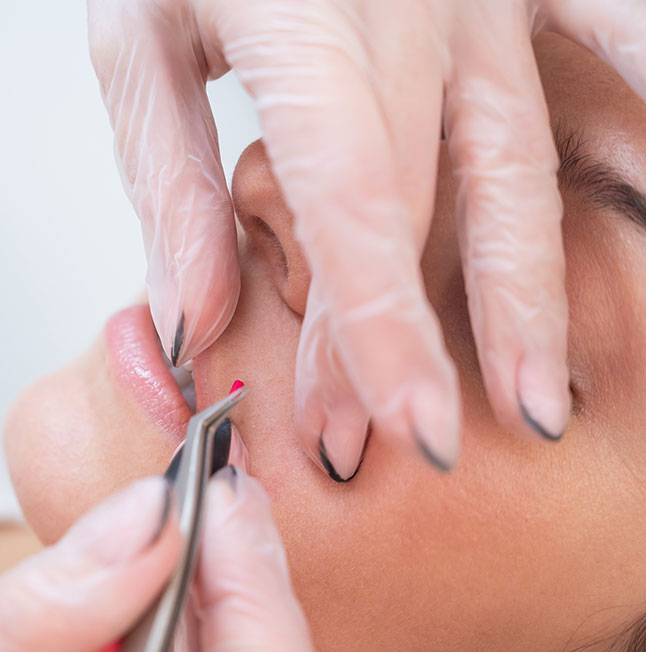Electrolysis Hair Removal