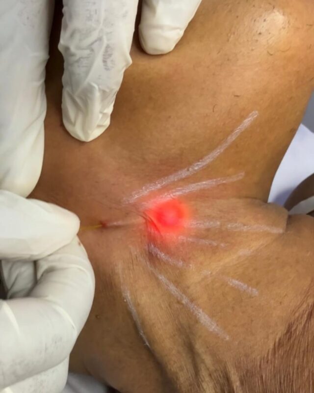 neck tightening services in nairobi kenya