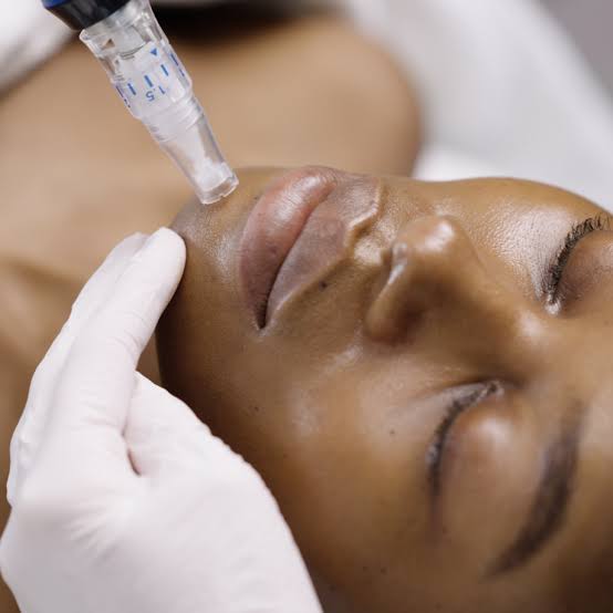 Exosomes therapy